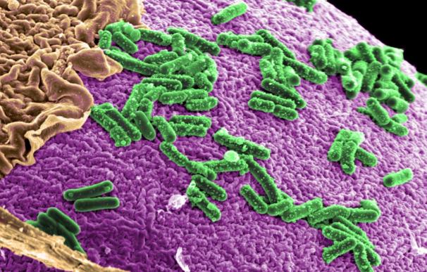Los microbios en el intestino ayudan a determinar el riesgo de tumores