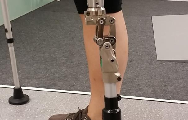 El Hospital de Mataró logra conectar una prótesis directamente a un fémur amputado