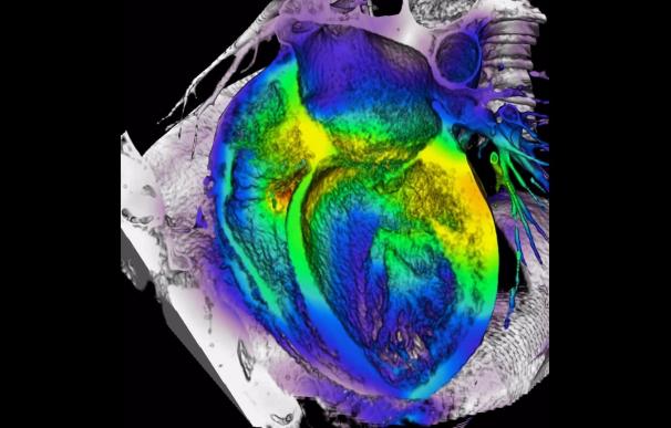 La grasa situada alrededor del corazón predice el riesgo cardiovascular y de diabetes tipo 2