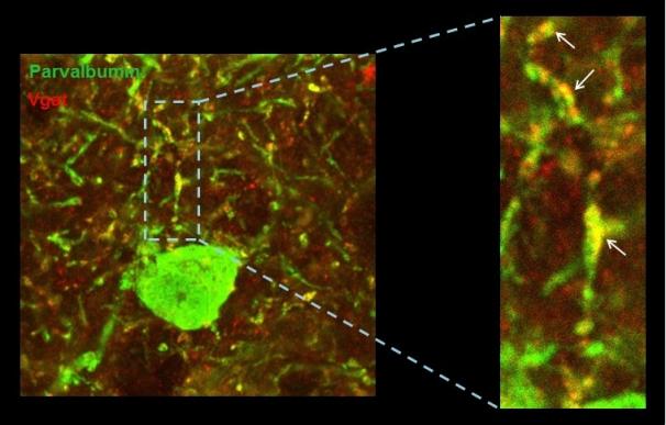 Identifican alteraciones del circuito neuronal vinculadas al Síndrome de Down