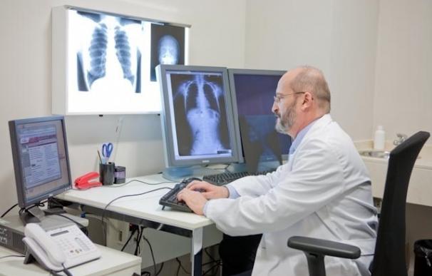 Los hombres necesitan más pruebas de detección del cáncer de pulmón que las mujeres