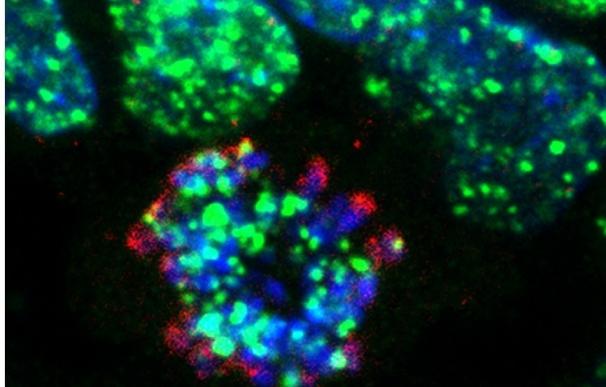El CNIO descubre un nuevo mecanismo de resistencia a la quimioterapia