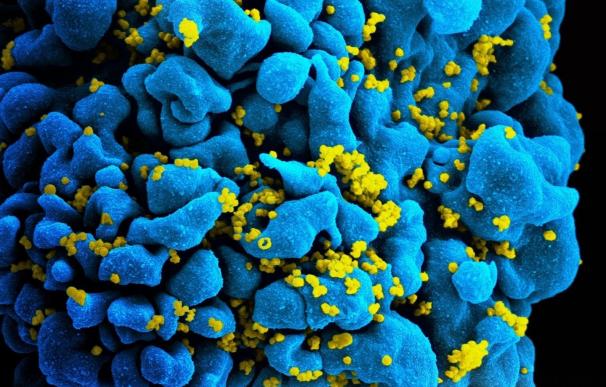 Científicos consiguen vislumbrar anticuerpos 'adolescentes' neutralizantes contra el VIH