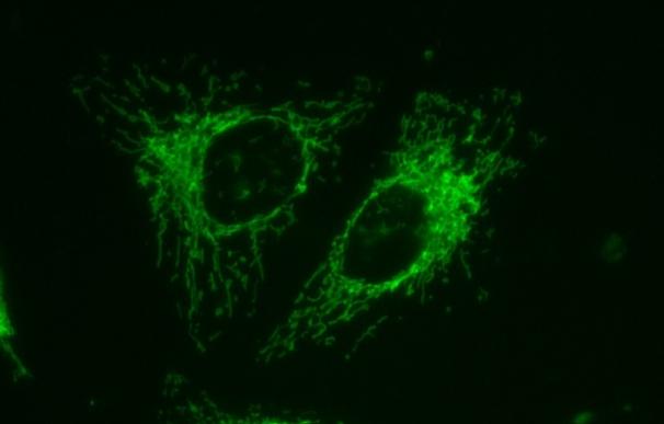 Investigadores descubren nuevos datos sobre las mutaciones que generan la neuropatía óptica hereditaria de Leber
