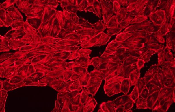 Grupos de células tumorales circundantes consiguen pasar por pequeños vasos sanguíneos para promover la metástasis