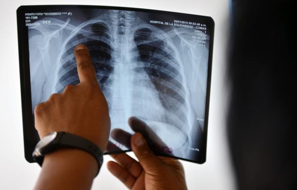 Un médico en Perú observa una radiografía