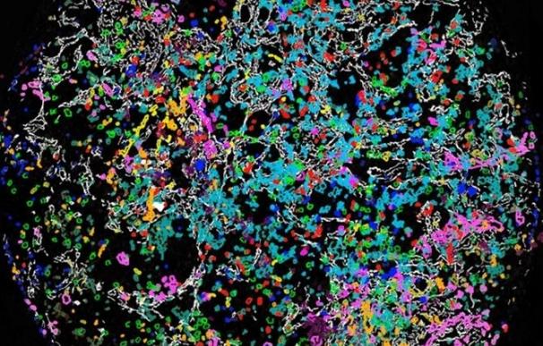 Investigadores de Incliva muestran que elementos de la matriz extracelular influyen en la agresividad del neuroblastoma