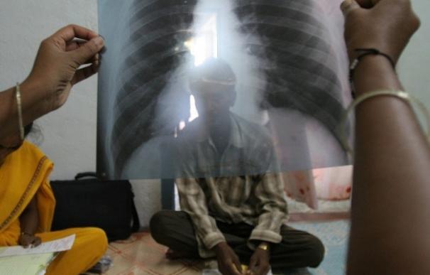 El número de casos de tuberculosis en India es dos o tres veces superior a las estimaciones actuales, según un estudio