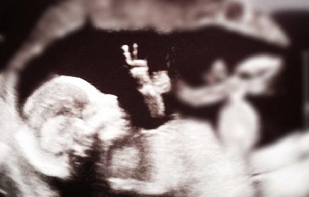 Una ecografía muestra supuestamente a un bebé haciendo el signo de la paz