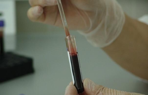 Científicos crean un 'test' para detectar rápidamente infecciones bacterianas, como la meningitis y neumonía