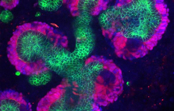 Investigadores desarrollan un nuevo método que permite generar fuente inagotable de células progenitoras renales humanas