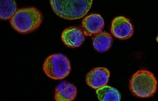Científicos demuestran que las células tumorales matan a células de la pared vascular para crear metástasis