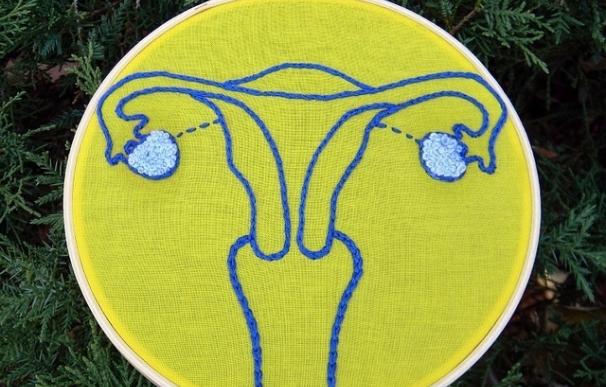 La infertilidad relacionada con la edad podría producirse por la cicatrización excesiva de los ovarios