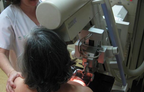 Más de 5.300 extremeñas se someterán a mamografías en abril