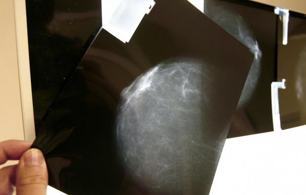 Una clínica pagará 99.716 euros por las secuelas de una operación de mamas