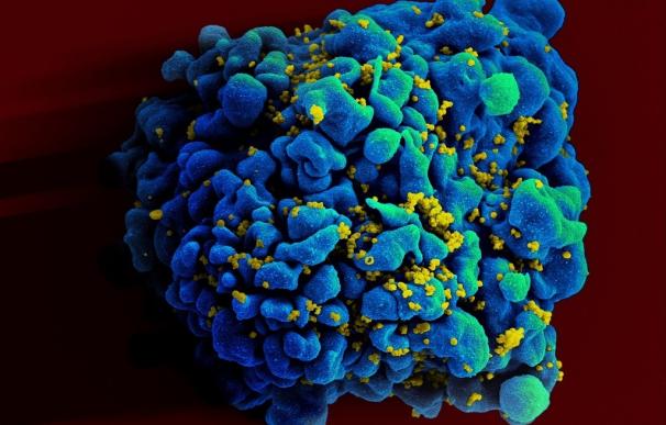 La propagación del VIH por el mundo occidental refleja su "paisaje geopolítico"