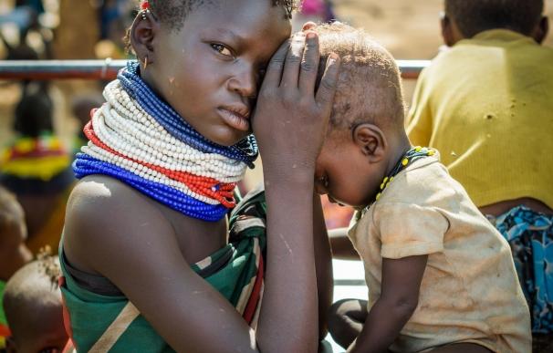 World Vision alerta de la "urgente necesidad" en el este de África, donde 700.000 niños están al borde de la muerte