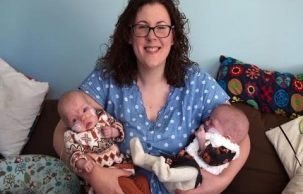Twin Girls Born At Just 23 Weeks Were So Tiny They Fitted In One Hand