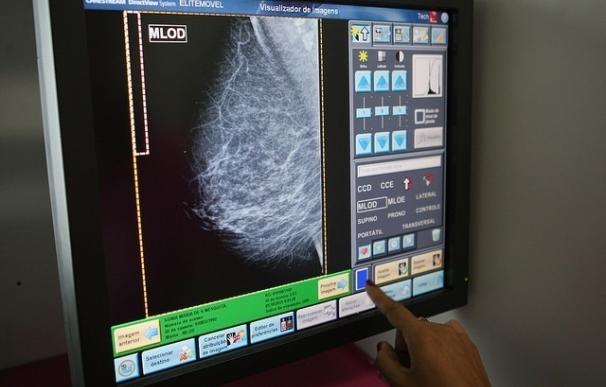 Casi 8.500 extremeñas se someterán a mamografías en marzo dentro del Programa de Detección Precoz del Cáncer de Mama