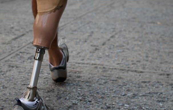 La Federación de Ortesistas y Protesistas denuncia deficiencias de la prestación ortoprotésica en España