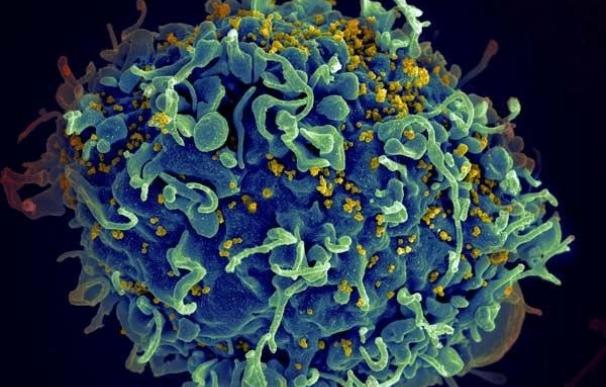 Investigadores identifican la cronología de la replicación del VIH en el cerebro