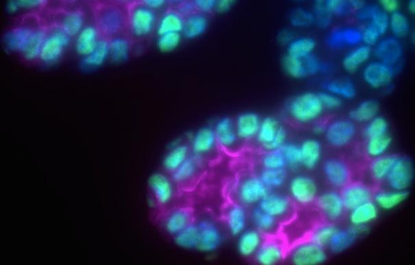Investigadores han descubierto una nueva forma eficiente de generar células tiroideas