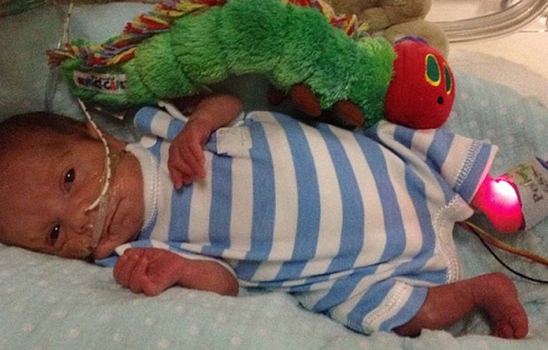 Michael Moloney, bebé británico que nació con 26 semanas de gestación