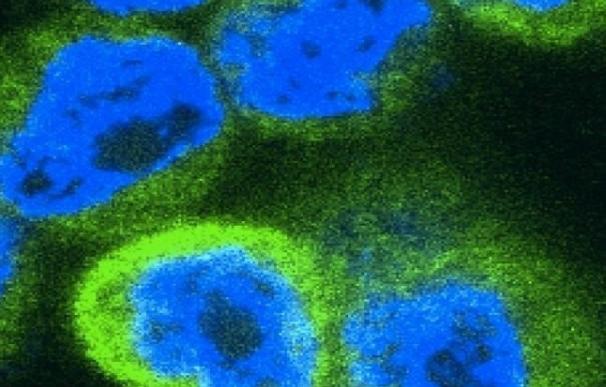 Investigadores identifican cómo los cánceres engañan al sistema inmunológico en su beneficio