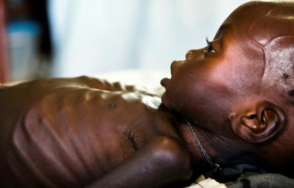 Sudán del Sur, sumido en la hambruna por la guerra
