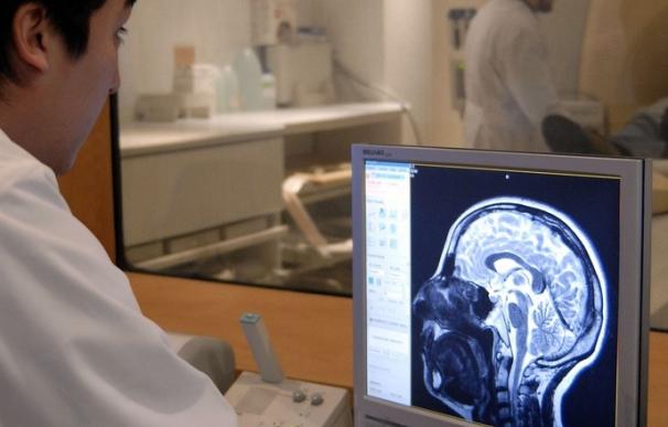 El amiloide comienza a acumularse en los cerebros adultos jóvenes