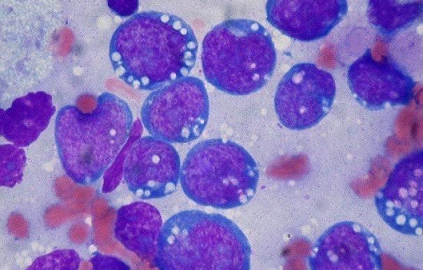 Investigadores del CNIC han descubierto una nueva diana que podría ayudar a tratar dos de los linfomas más agresivos