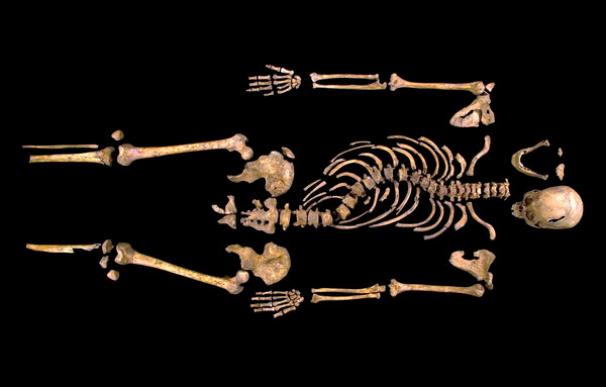 Huesos de Ricardo III: la columna vertebral con escoliosis. No era jorobado.
