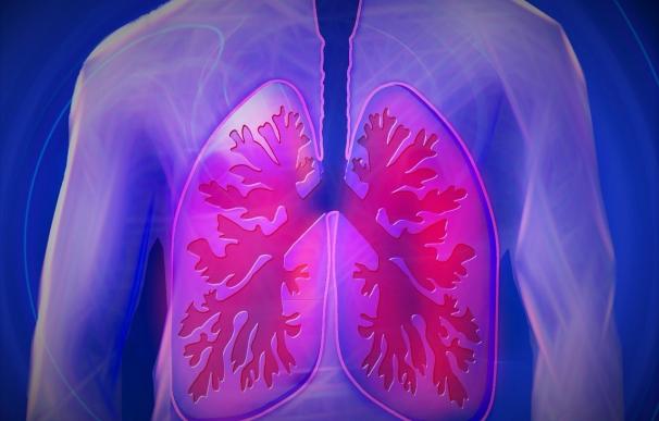 Afectados por hipertensión pulmonar piden mejorar su diagnóstico y evitar que se confunda con otras patologías