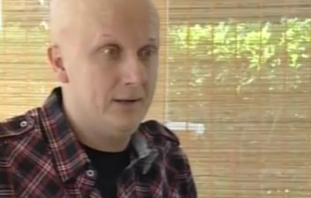 Detenido por estafa un afectado por el síndrome de Cowden que pedía dinero para tratarse de 2.000 tumores