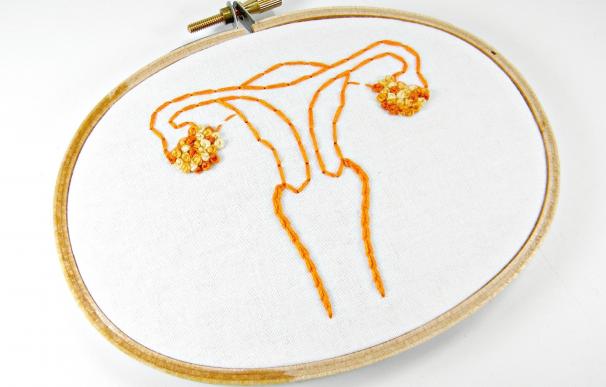 La extirpación preventiva de ovarios llega al 90% de mujeres con riesgo de cáncer heredado