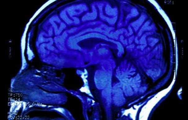 Vista lateral de un cerebro a través de una resonancia magnética