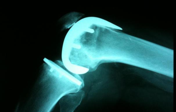 Investigadores vascos desarrollan un recubrimiento más resistente para las prótesis de titanio