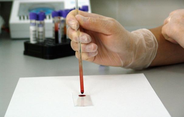 Una prueba de papel determina con precisión el grupo sanguíneo en segundos