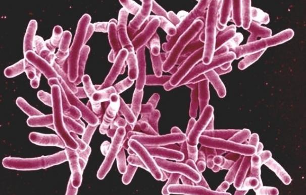 Científicos hallan un nuevo mecanismo para superar la resistencia de la tuberculosis
