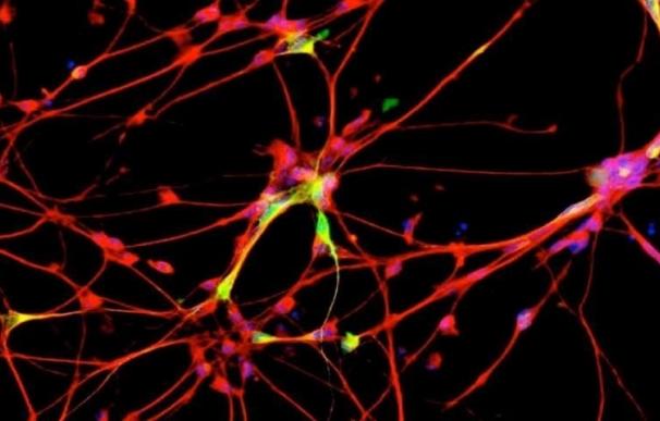 El Hospital de Parapléjicos coordina un estudio europeo que probará una terapia para reparar la mielina de las neuronas