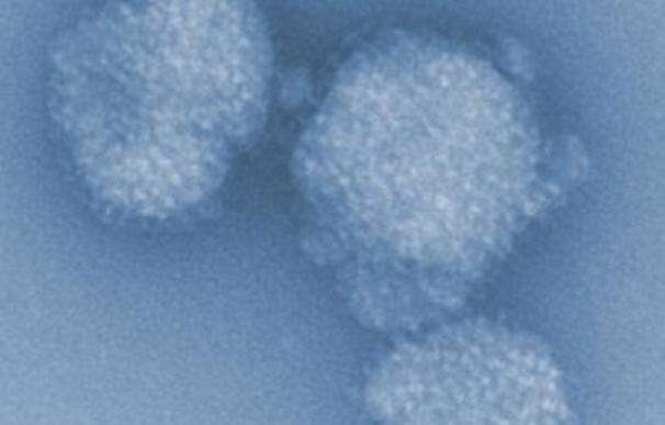 La reducida inmunidad durante el embarazo promueve la evolución de gripe más virulenta