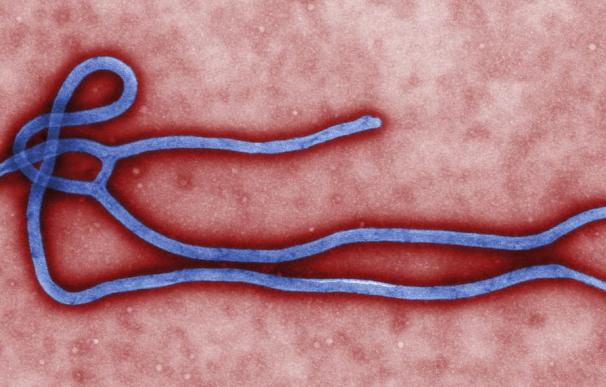 Descubren cómo el virus del ébola inhabilita el sistema de inmunidad