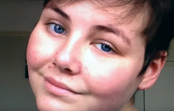 Charlotte, la chica que luchó contra el cáncer frente a sus seguidores en Youtube