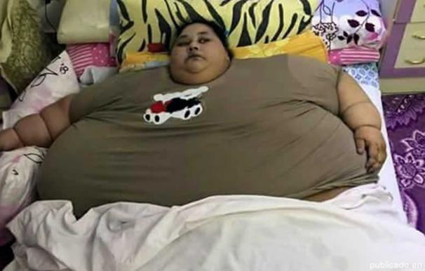 La mujer más gorda del mundo, antes de la operación.