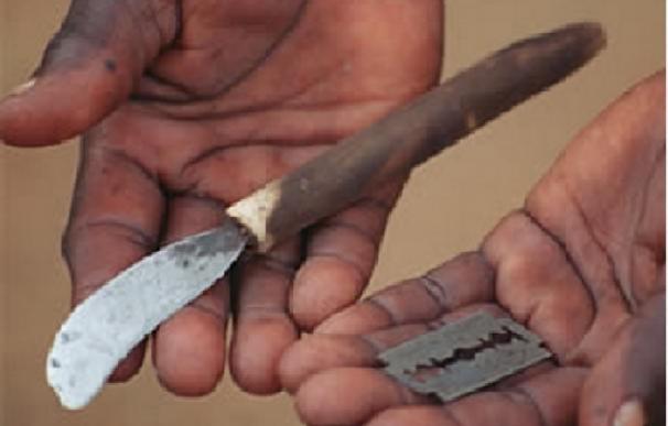 Cada seis minutos, una niña es víctima de la mutilación genital en el mundo