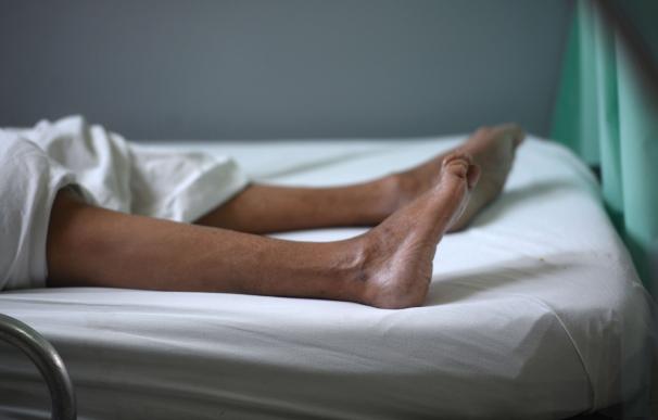The legs of a patient suffering from the Guillain-