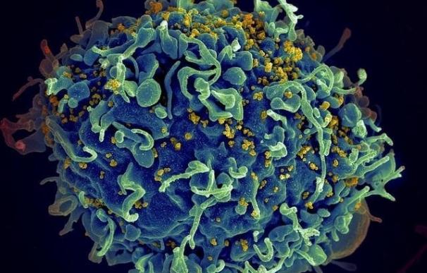 El VIH "secuestra" una molécula de la superficie de la célula para invadirla