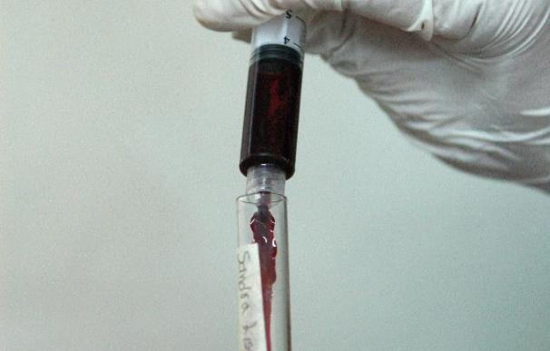 El Hospital Clínic prueba con éxito una vacuna que disminuye la carga viral de los enfermos del sida