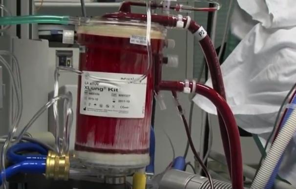El Hospital Quirónsalud Sur, el único privado de España en ofrecer la técnica de oxigenación de membrana