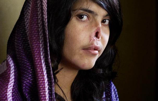 Una imagen de una afgana vence en un World Press Photo con protagonismo español